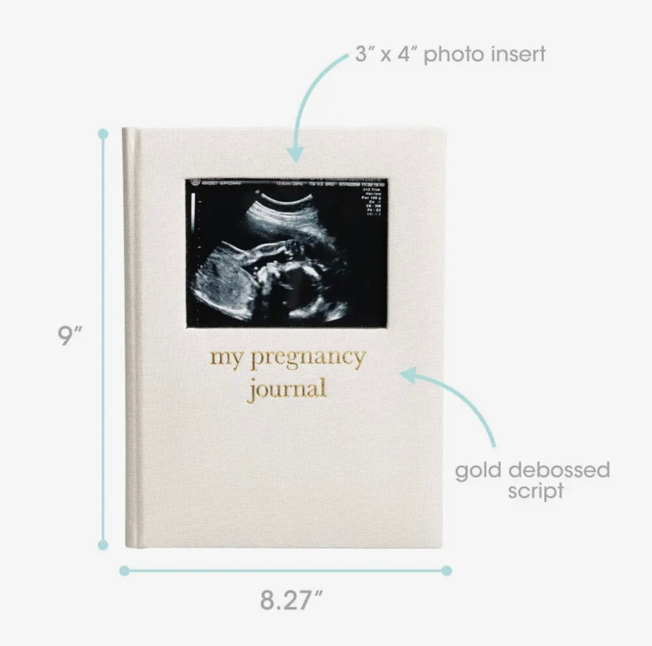 Pregnancy Memory Journal - Best Seller